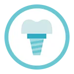 Impianti Dentali - Buongiorno Odontoiatrica