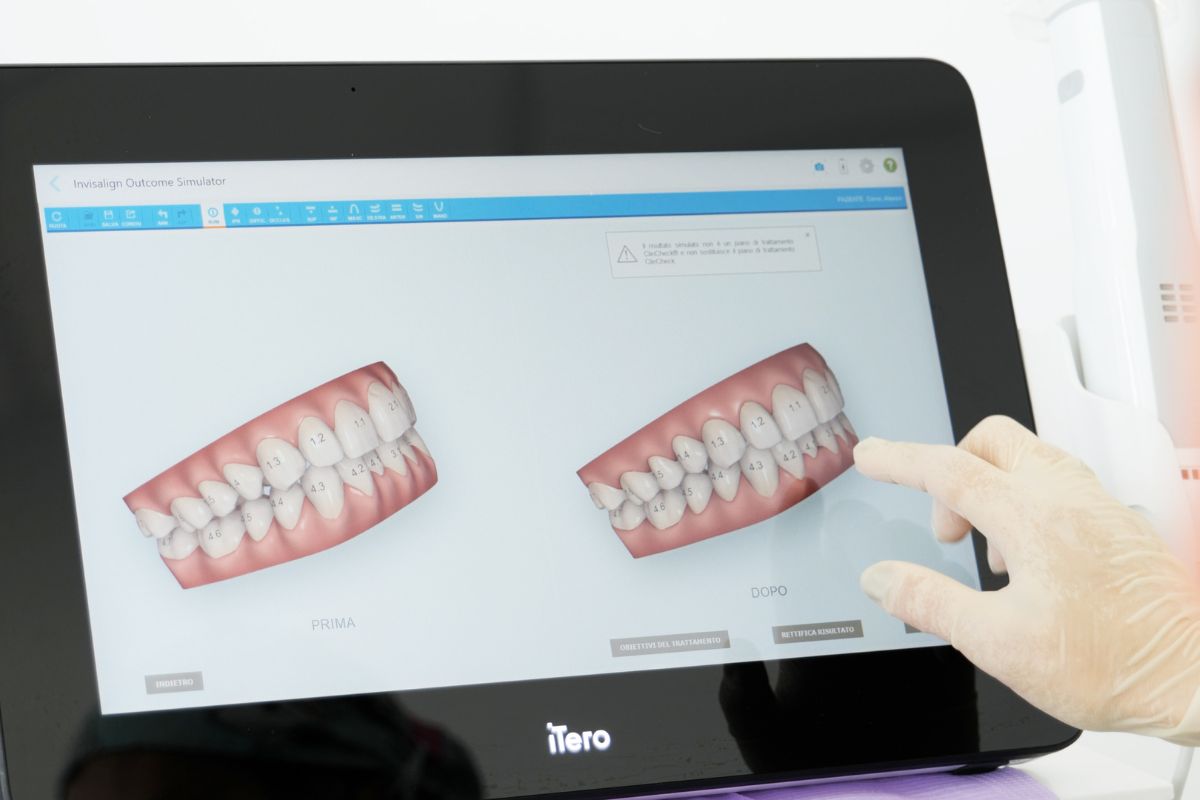digital-smile-design-studi-buongiorno