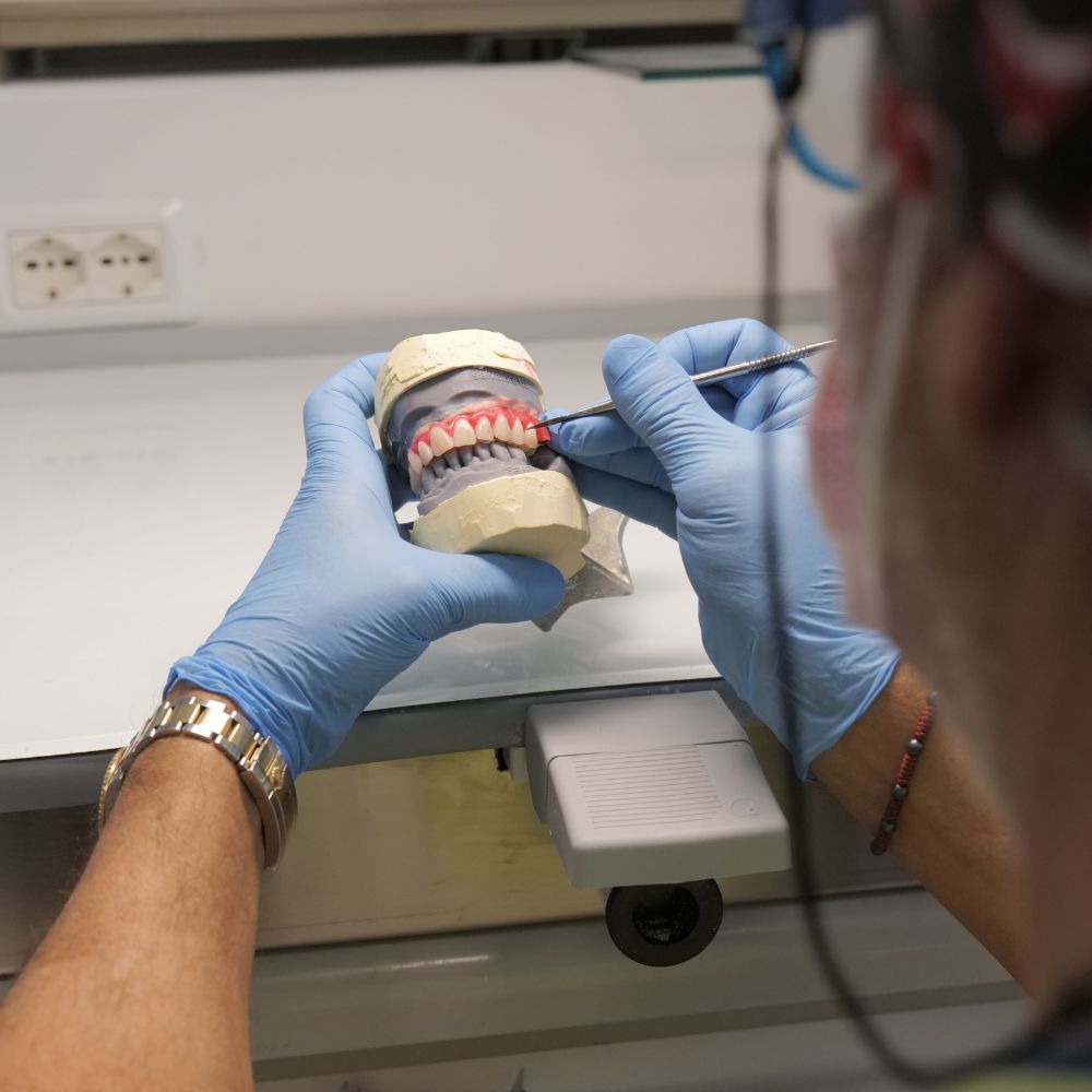 il-metodo-denti-fissi-in-4-ore2