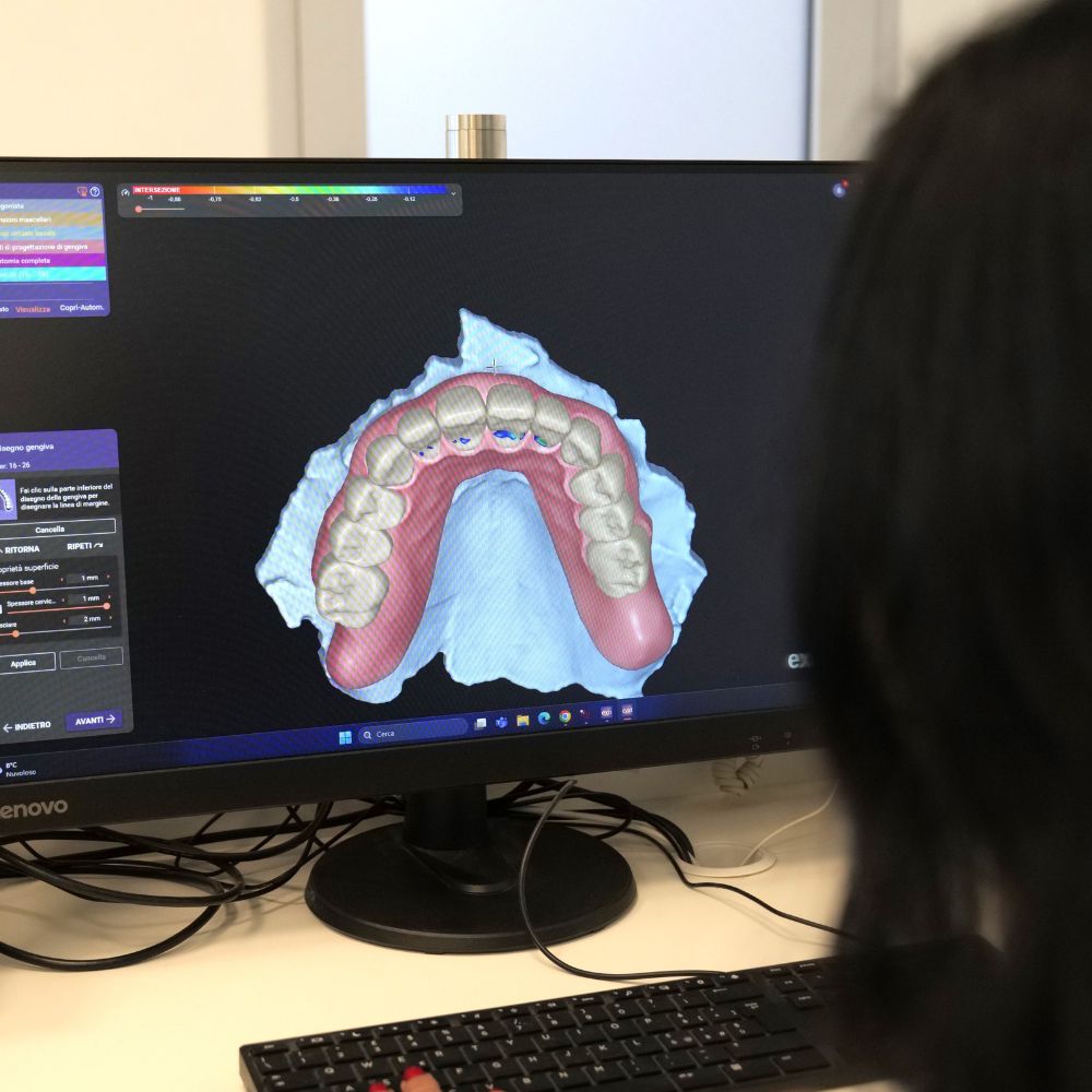 il-metodo-denti-fissi-in-4-ore3