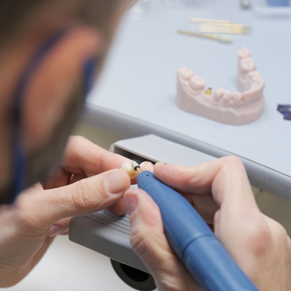 il-metodo-denti-fissi-in-4-ore4